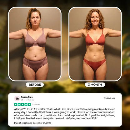 Kalm Bracelet - Your Weight Loss Solution